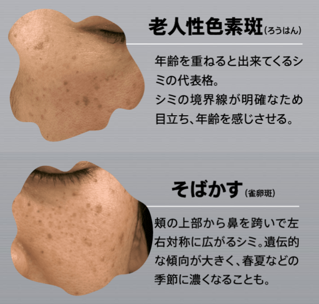 おためし新商品ナビ » Blog Archive » 飲むだけ簡単！ 顔と全身のシミケアができる医薬品『コーズシックス ホワイトプレミアム』を体験！